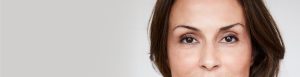 Upper Eyelid Lift