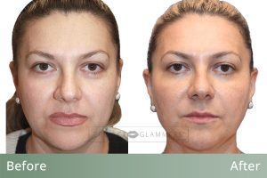 PG_BAs_Template_A (1)