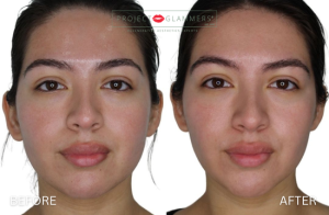 Gallery_RestoreContour (2)