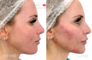 Gallery_RestoreContour (3)