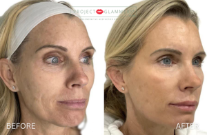 Gallery_RestoreContour