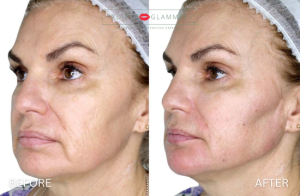 Gallery_RestoreContour (4)