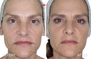 Gallery_RestoreContour (5)