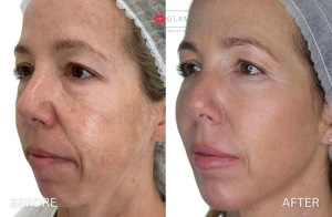 Gallery_RestoreContour (6)